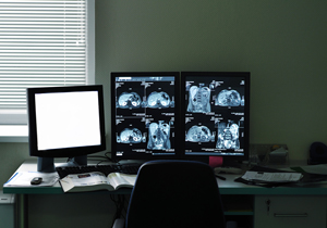 Picture of a Radiology room with screens that have MRI brain scans.